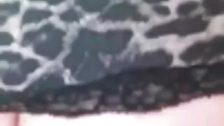 Ufimchanka нь шулуун гэдсээр огцом татаж ч хэвээр биш үү.